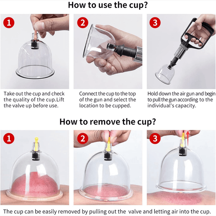 Kylin Professional Cupping Therapy 24pc Set